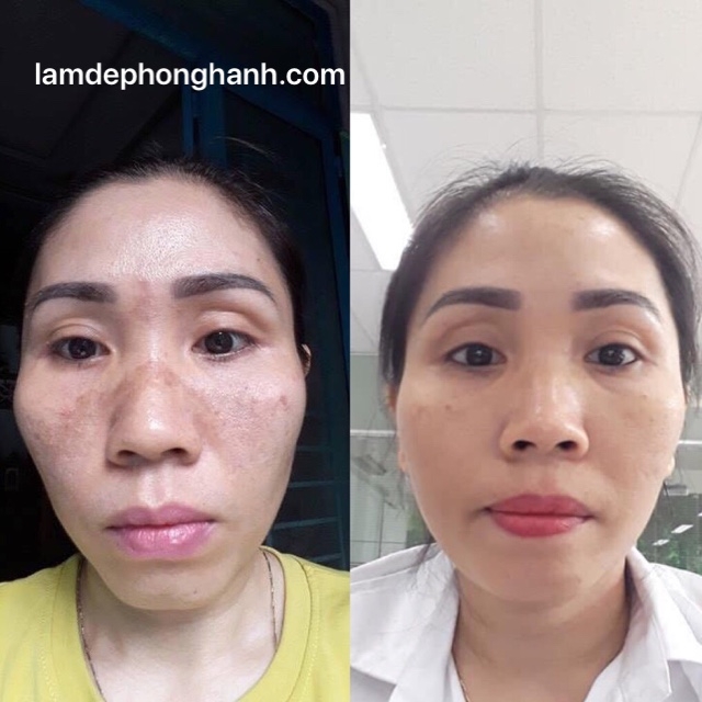 Thảo Dược Hồng Hạnh