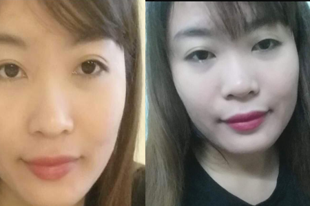 Feedback trị nám mụn nội tiết với Thảo Dược Hồng Hạnh

